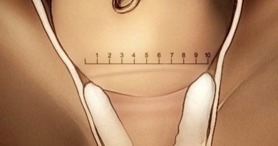 Dilatación en el trabajo de parto no lineal