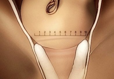 ¿Hay que dilatar 1 cm por hora? La verdad sobre la progresión del trabajo de parto Dilatación en el trabajo de parto no lineal